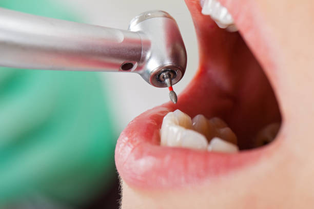 Best Broken Tooth Emergency  in Bethany, WV